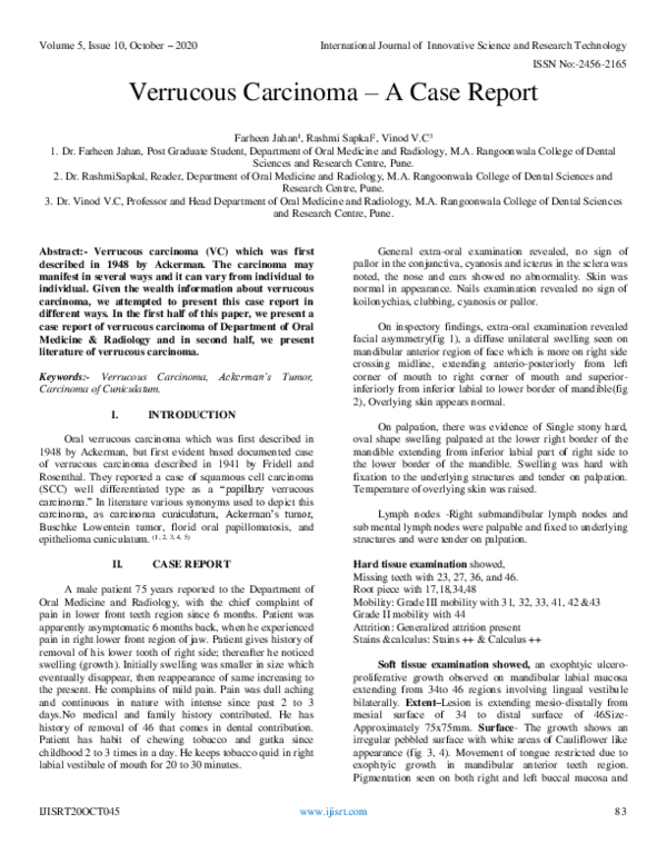 (PDF) Verrucous Carcinoma – A Case Report