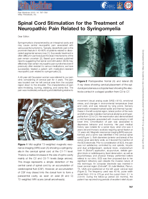 (PDF) Spinal Cord Stimulation for the Treatment of Neuropathic Pain ...