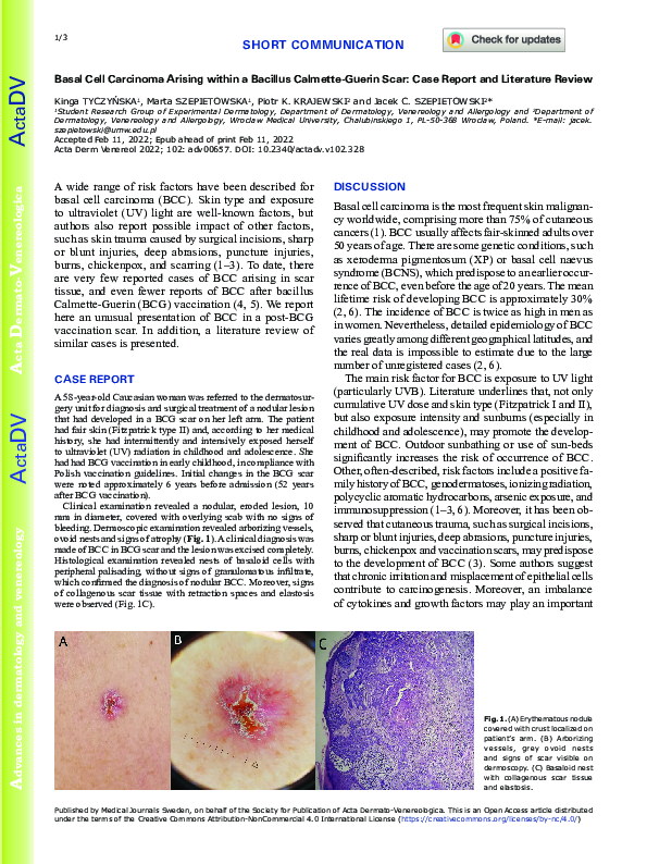 (PDF) Basal Cell Carcinoma Arising within a Bacillus Calmette-Guerin ...