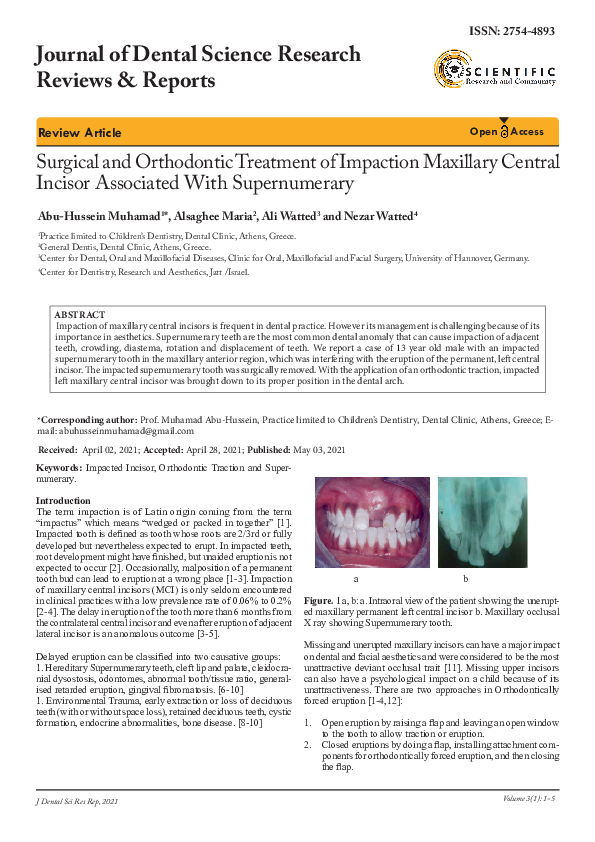 (PDF) Surgical and Orthodontic Treatment of Impaction Maxillary Central ...