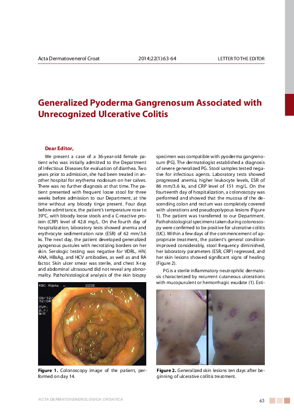 (PDF) Generalized pyoderma gangrenosum associated with unrecognized ...
