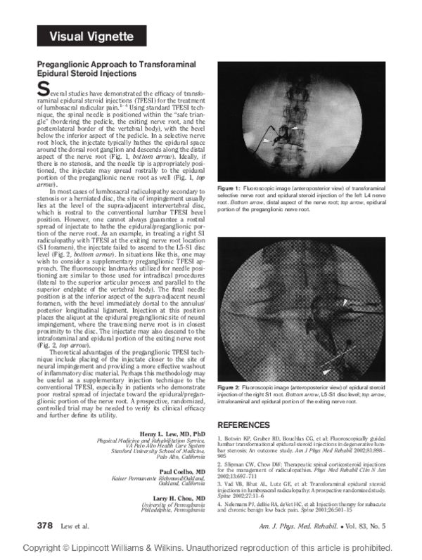 (PDF) Preganglionic Approach to Transforaminal Epidural Steroid Injections