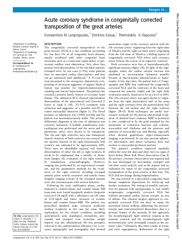 (PDF) Acute coronary syndrome in congenitally corrected transposition ...