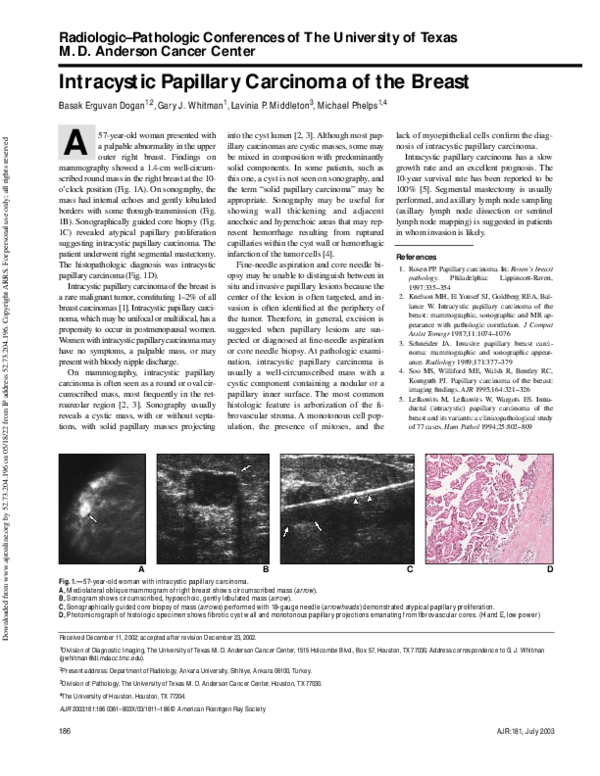 (PDF) Intracystic Papillary Carcinoma of the Breast