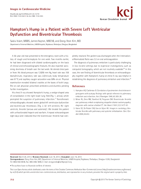 (PDF) Hampton's Hump in a Patient with Severe Left Ventricular ...