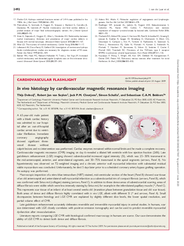(PDF) In vivo histology by cardiovascular magnetic resonance imaging