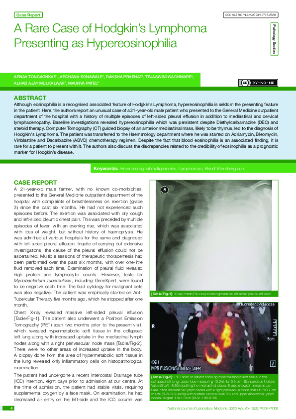 (PDF) A Rare Case of Hodgkin’s Lymphoma Presenting as Hypereosinophilia