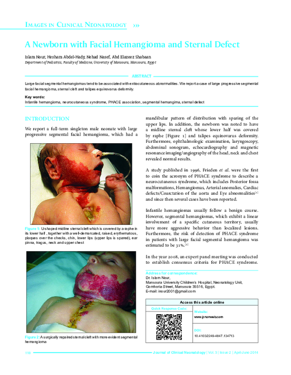 (PDF) A newborn with facial hemangioma and sternal defect