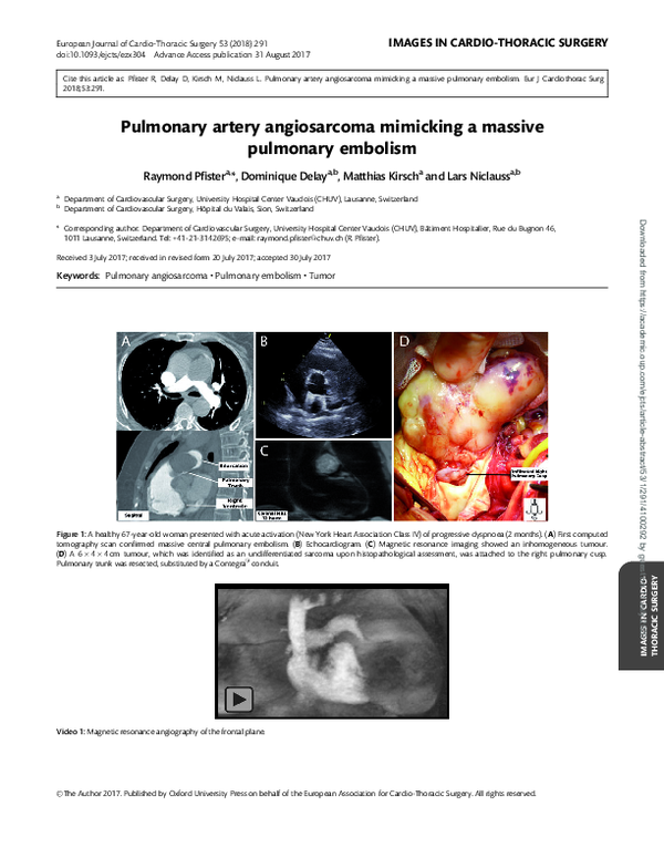 (PDF) Pulmonary artery angiosarcoma mimicking a massive pulmonary embolism