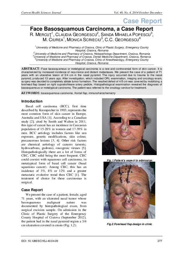 (PDF) Face Basosquamous Carcinoma, a Case Report