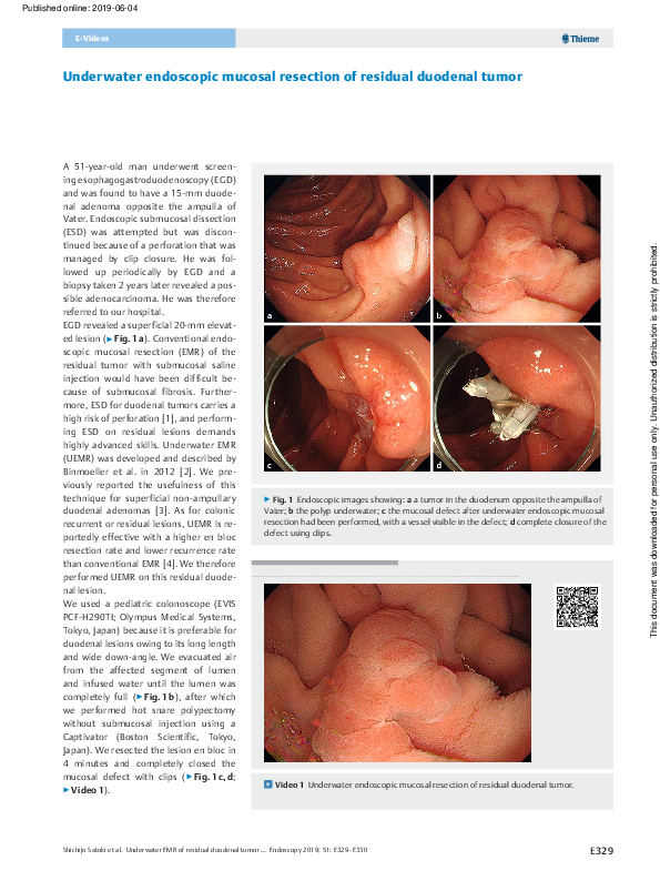 (PDF) Underwater endoscopic mucosal resection of a duodenal ...