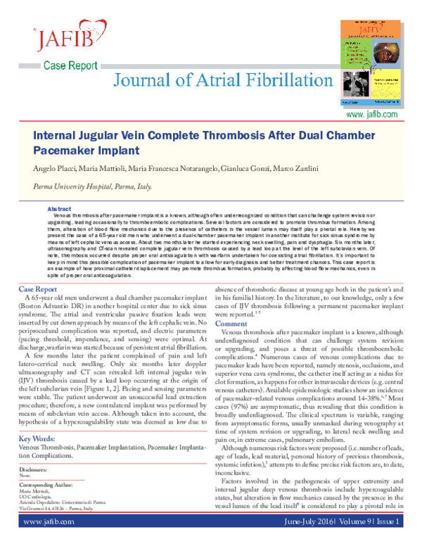 (PDF) Internal Jugular Vein Complete Thrombosis After Dual Chamber ...