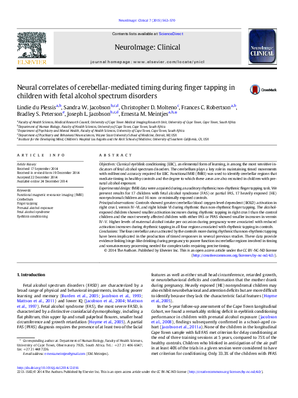 (PDF) Neural correlates of cerebellar-mediated timing during finger ...