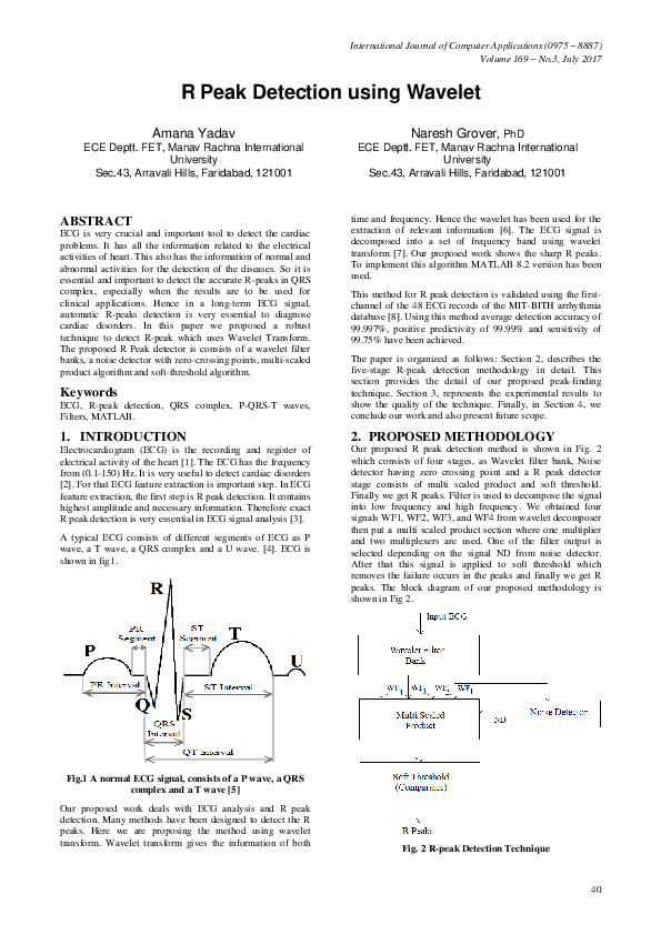 (PDF) R Peak Detection using Wavelet