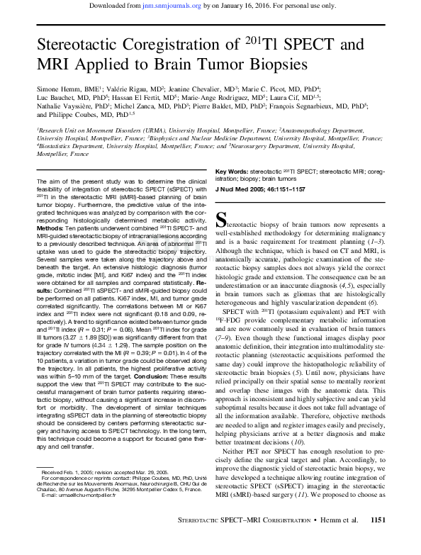 (PDF) Stereotactic coregistration of 201Tl SPECT and MRI applied to ...