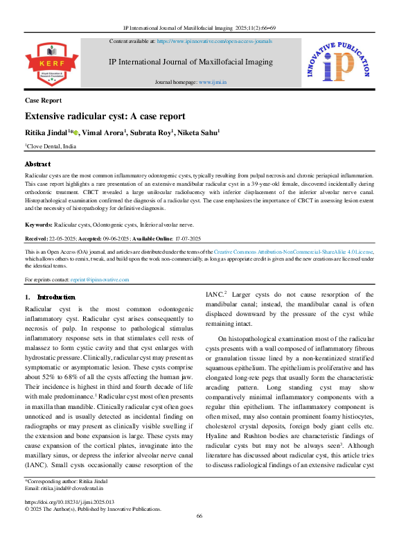 (PDF) Extensive radicular cyst: A case report