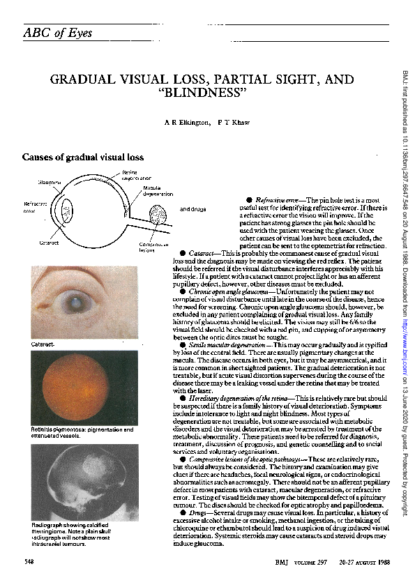 (PDF) ABC of eyes. Gradual visual loss, partial sight, and 
