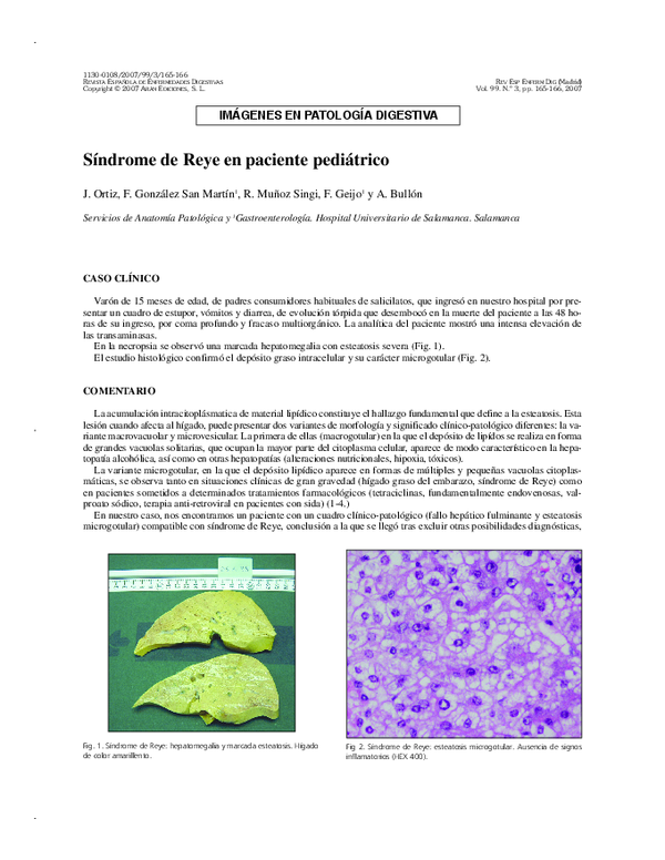 (PDF) Síndrome de Reye en paciente pediátrico
