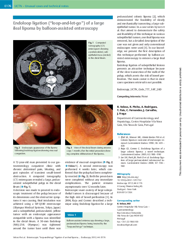 (PDF) Endoloop ligation (“loop-and-let-go”) of a large ileal lipoma by ...