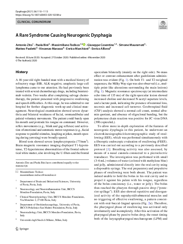 (PDF) A Rare Syndrome Causing Neurogenic Dysphagia