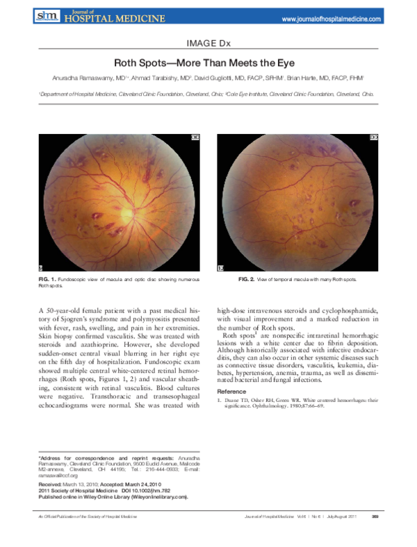 (PDF) Roth spots—more than meets the eye
