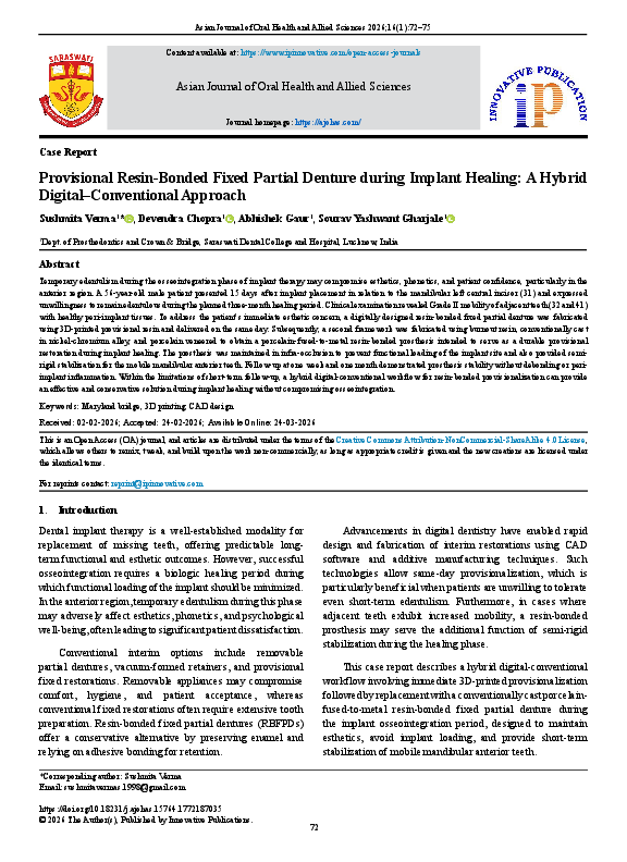 (PDF) Provisional Resin-Bonded Fixed Partial Denture during Implant ...