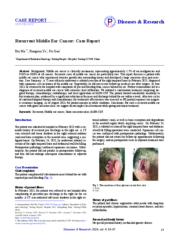 (PDF) Recurrent Middle Ear Cancer: Case Report
