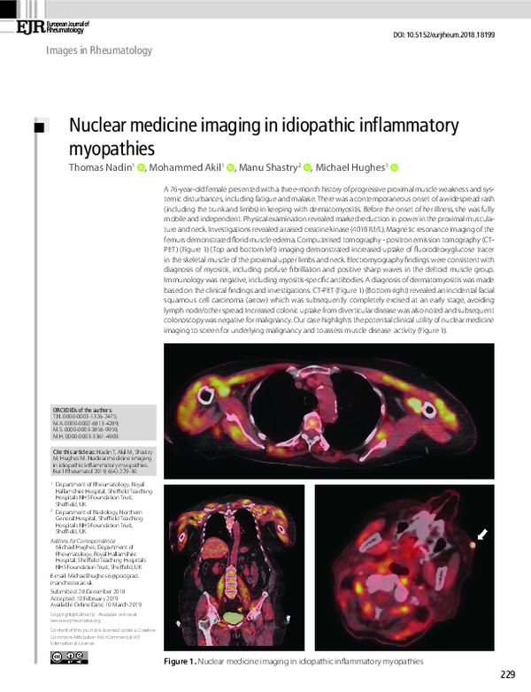 (PDF) Nuclear medicine imaging in idiopathic inflammatory myopathies