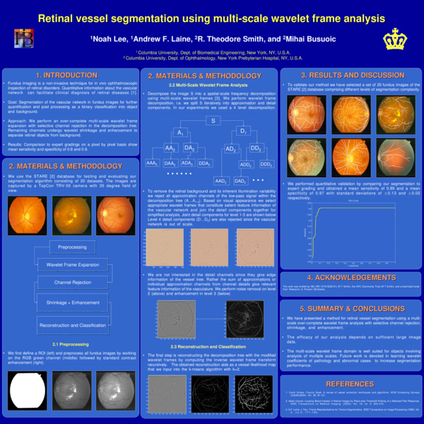 (PDF) Retinal vessel segmentation using multi-scale wavelet frame analysis