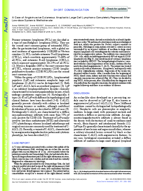 (PDF) A Case of Angioinvasive Cutaneous Anaplastic Large Cell Lymphoma ...