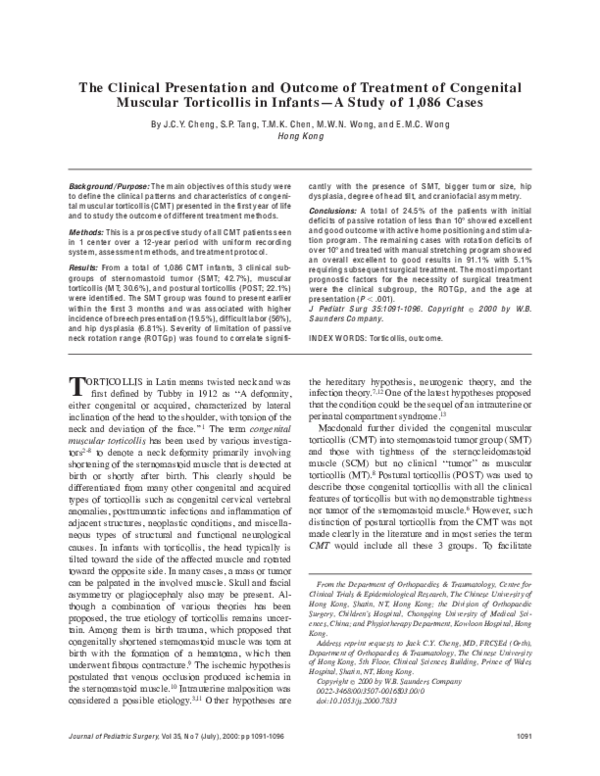 Types of torticollis picture