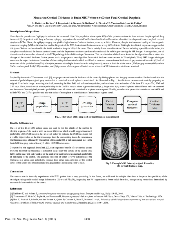 (PDF) Measuring Cortical Thickness in Brain MRI Volumes to Detect Focal ...