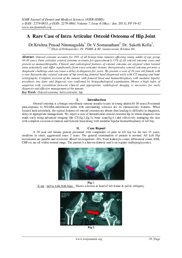 (PDF) A Rare Case of Intra Articular Osteoid Osteoma of Hip Joint