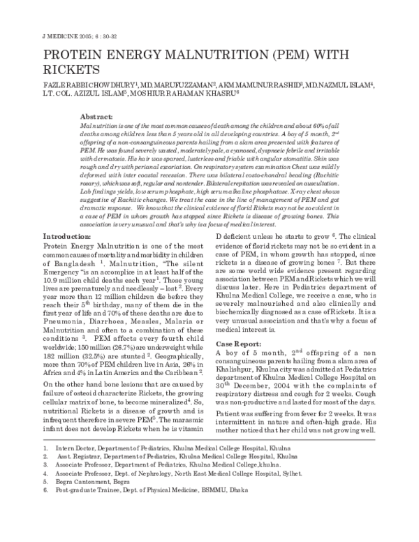 (PDF) Protein Energy Malnutrition (PEM) with Rickets Fazle Rabbi Chowdhury Academia.edu