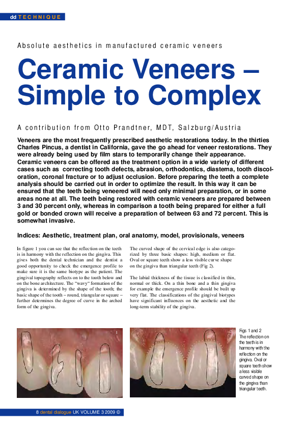 (PDF) Veneers Tecnico Dental Academia.edu