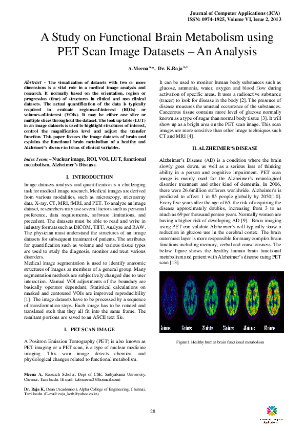 Pet scan indications picture