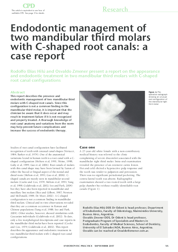 (PDF) Endodontic management of two mandibular third molars with C