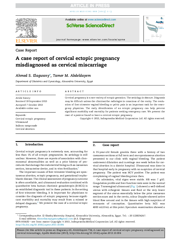 Ectopic pregnancy essay 07 image