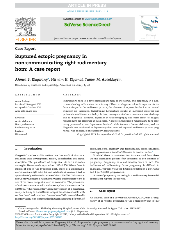 Ectopic pregnancy diagnosis and management picture
