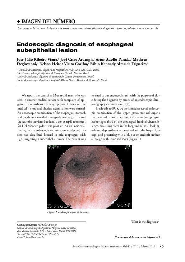 (PDF) Endoscopic diagnosis of esophageal subepithelial lesion José Celso Ardengh Academia.edu