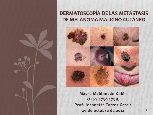 (PDF) DERMATOSCOPÍA DE LAS METÁSTASIS DE MELANOMA MALIGNO CUTÁNEO