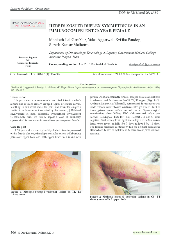 que es el herpes zoster pdf