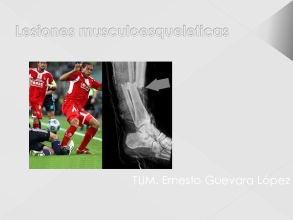 (PPT) Lesiones musculoesqueleticas