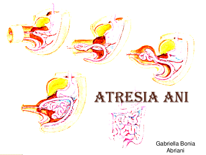 (PPT) Penyuluhan Atresia Ani