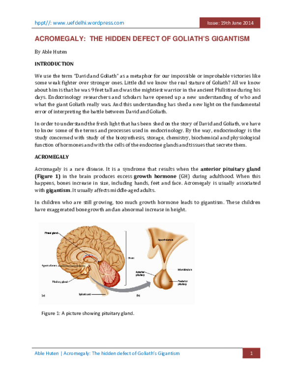 Causes of acromegaly picture