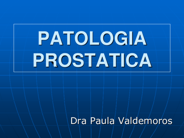 hiperplasia estromal de la próstata hiperplasia estromal de la próstata