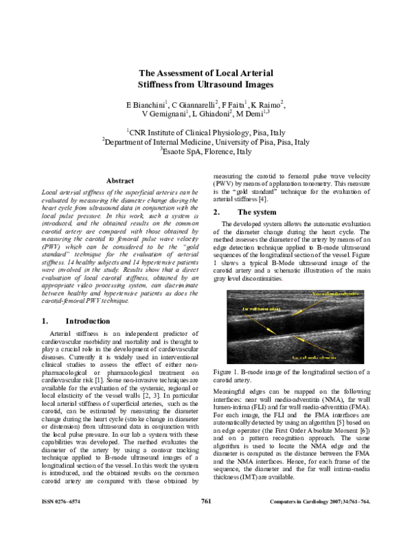 (PDF) The assessment of local arterial stiffness from ultrasound images