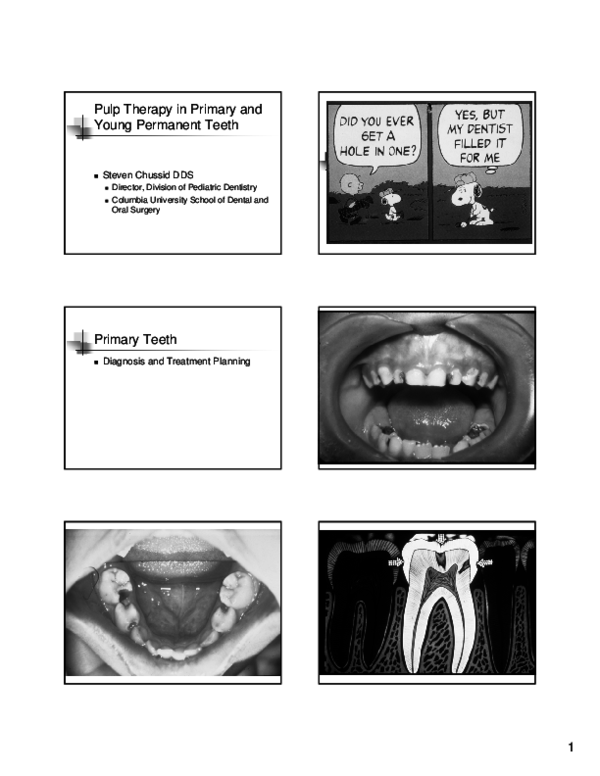 (PDF) Pulp Therapy in Primary and Young Permanent Teeth Primary Teeth ...