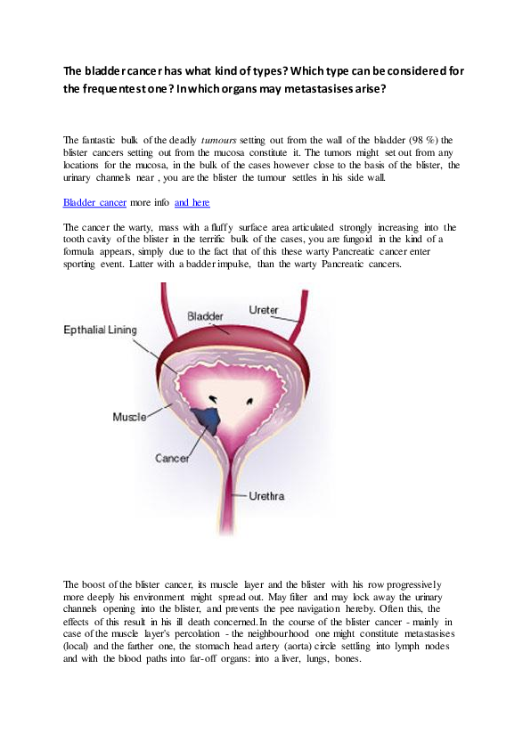 (PDF) Smoking Bladder Cancer wolf gabor Academia.edu