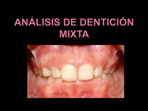 (PPT) Analisis de denticion mixta